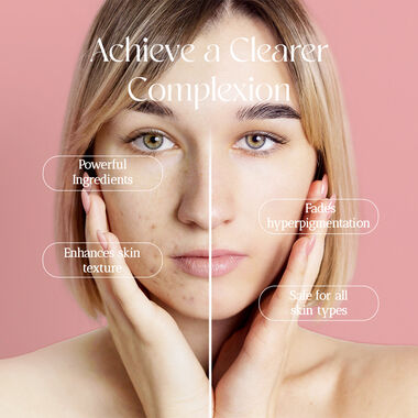 faces cicaderm cream