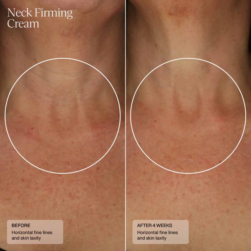 sente neck firming cream