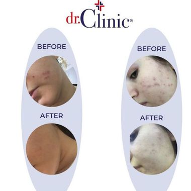 faces كريم كولاجين بريبايوتيك للوجه