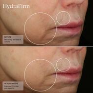 faces hydrafirm serum