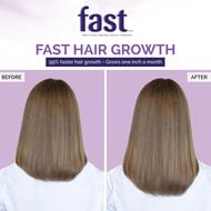 F.A.S.T. Fortified Amino Scalp Therapy Shampoo & Conditioner Set faces f a s t fortified amino scalp therapy shampoo conditioner set