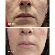 faces منظف   الأحماض الأمينية و الألوة فيرا 60 جرام