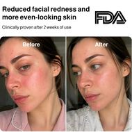 faces 4d laser light therapy mask