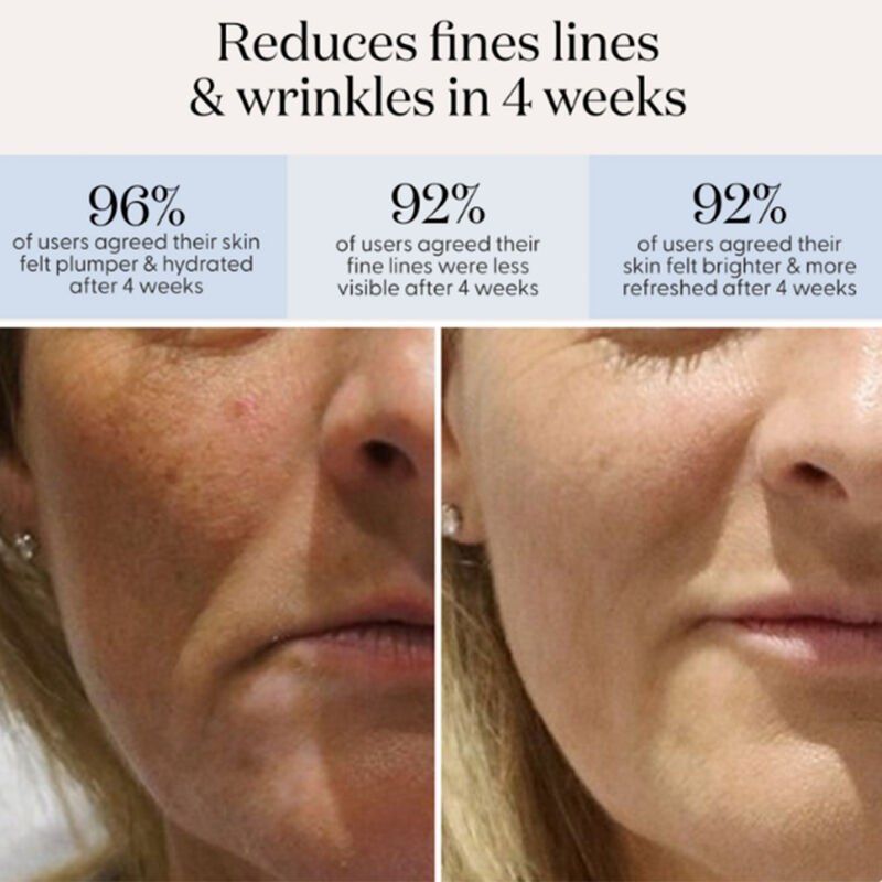 سموث سكين قناع الوجه led للعلاج بالضوء الأحمر