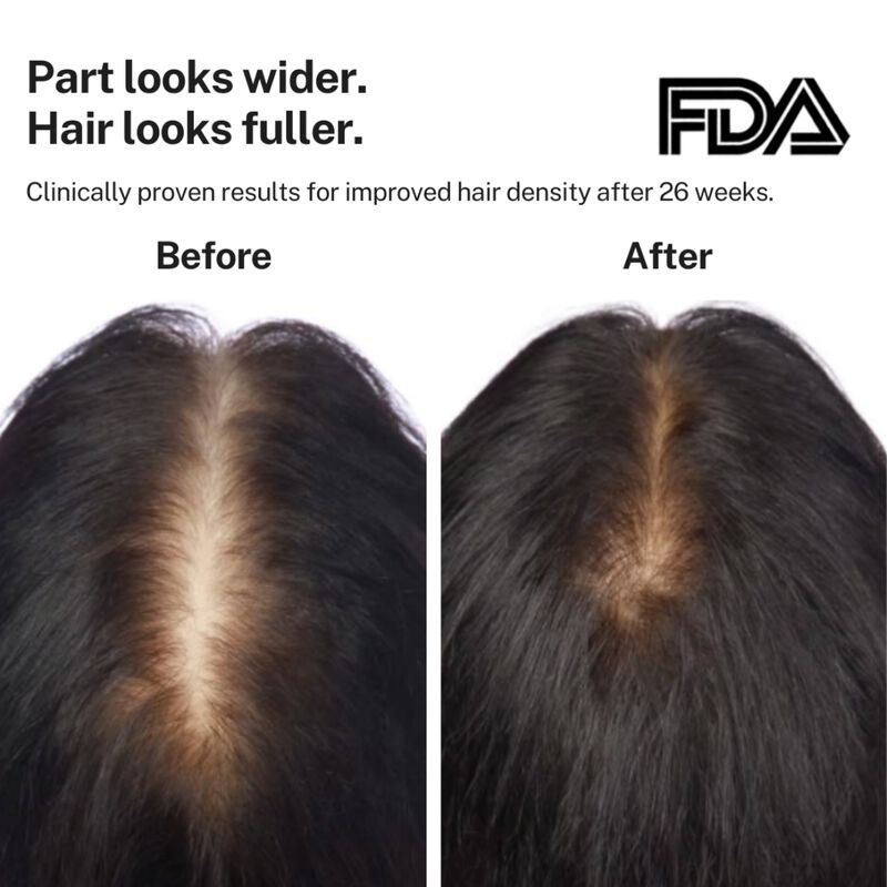hairmax powerflex 272 hair growth laser light cap