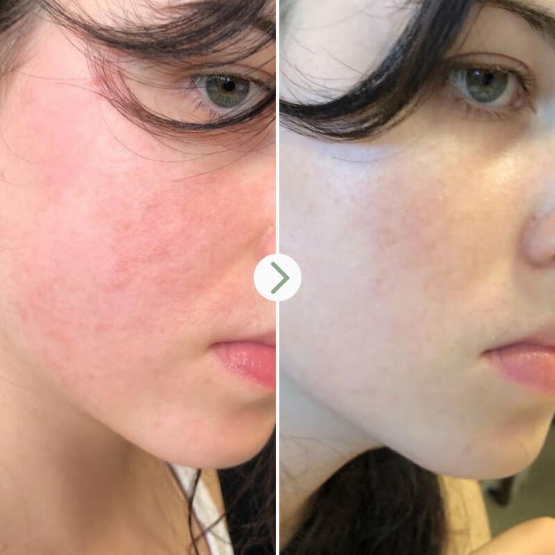 pai skincare the light fantastic face oil