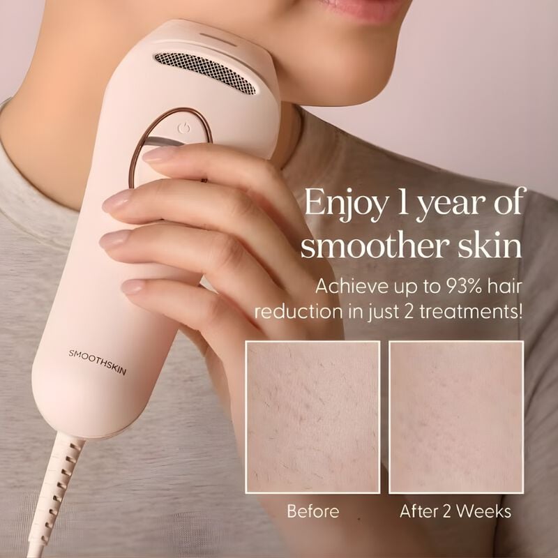 smoothskin ipl pure switch