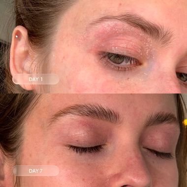 faces مجموعة مكافحة القشرة والخشونة