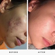 faces blue tansy aha   bha clarity mask