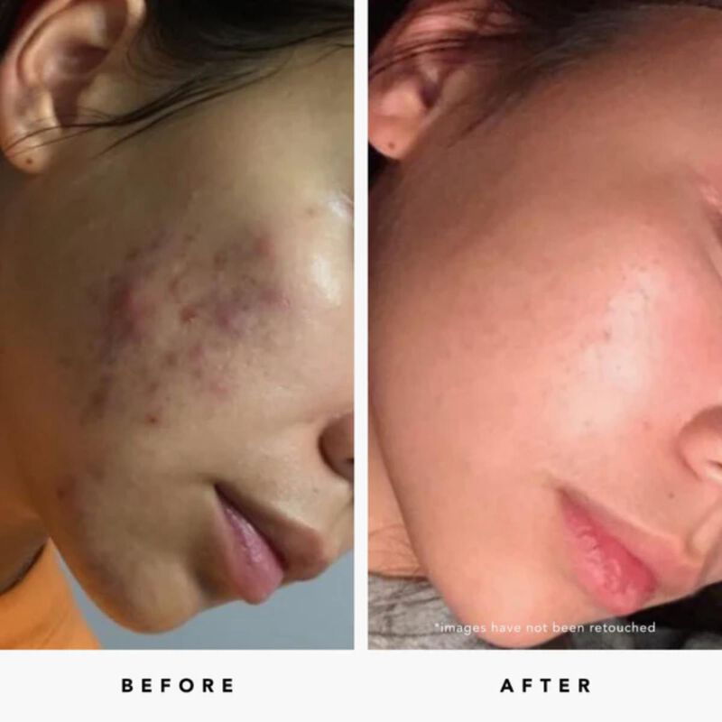 herbivore blue tansy aha + bha clarity mask