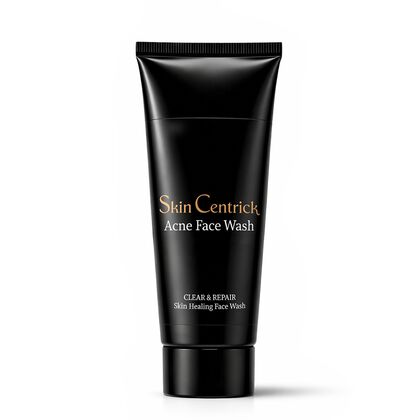 Acne Face Wash