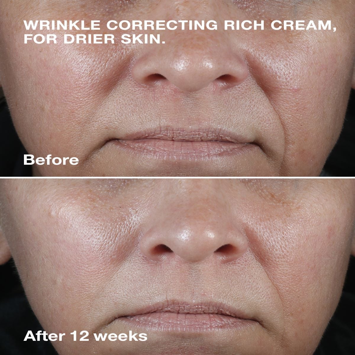 Smart Clinical Repair Wrinkle Cream Corrective 50ml