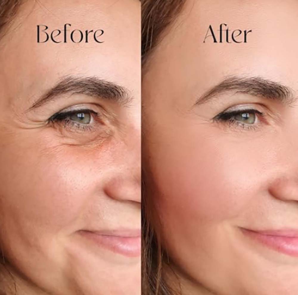 Hyaluronic Acid Serum