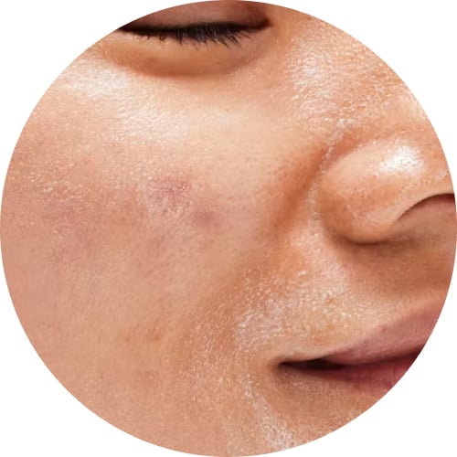 تسوق حسب نوع البشرة